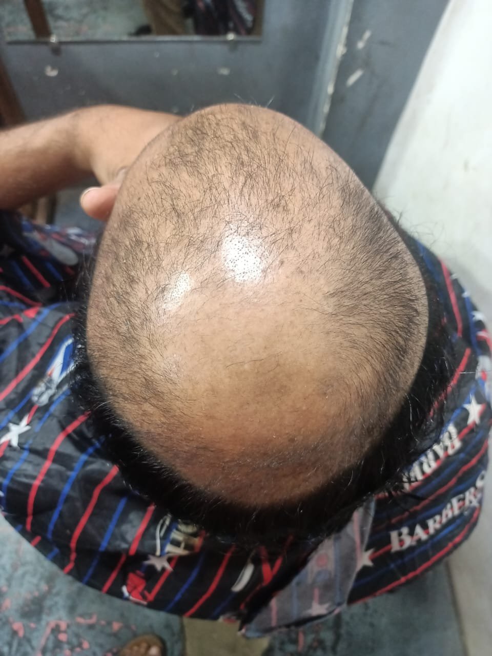 Before Hair Transformation