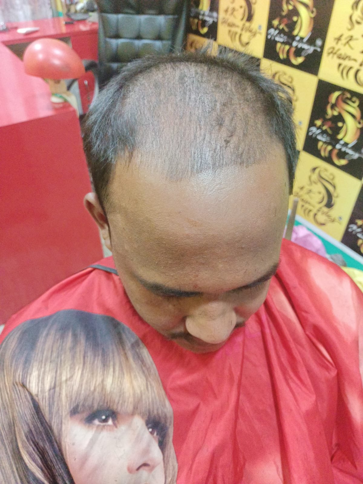 Before Hair Transformation