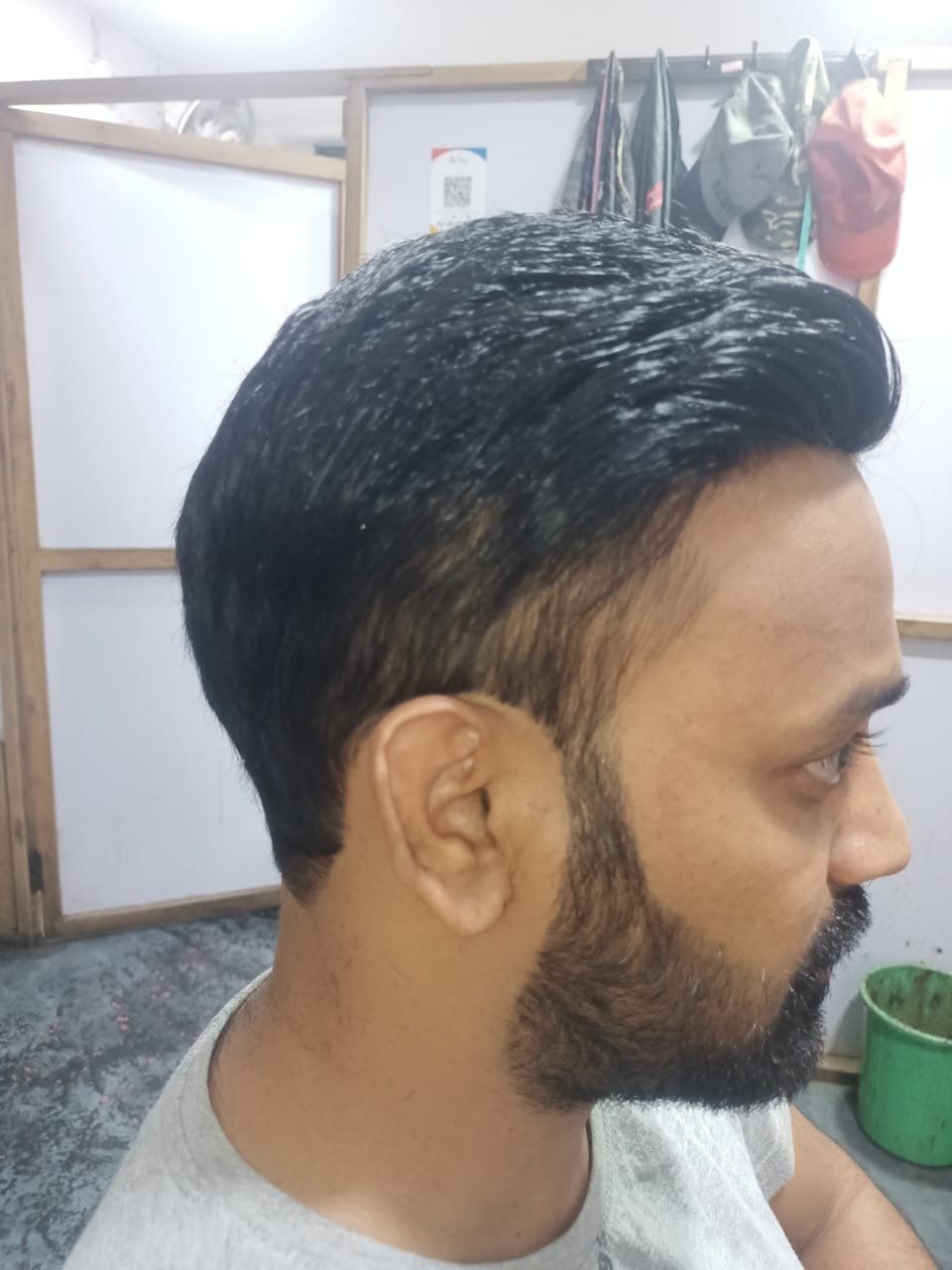 After Hair Transformation