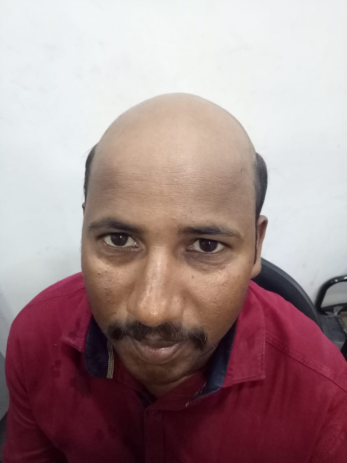 After Hair Transformation
