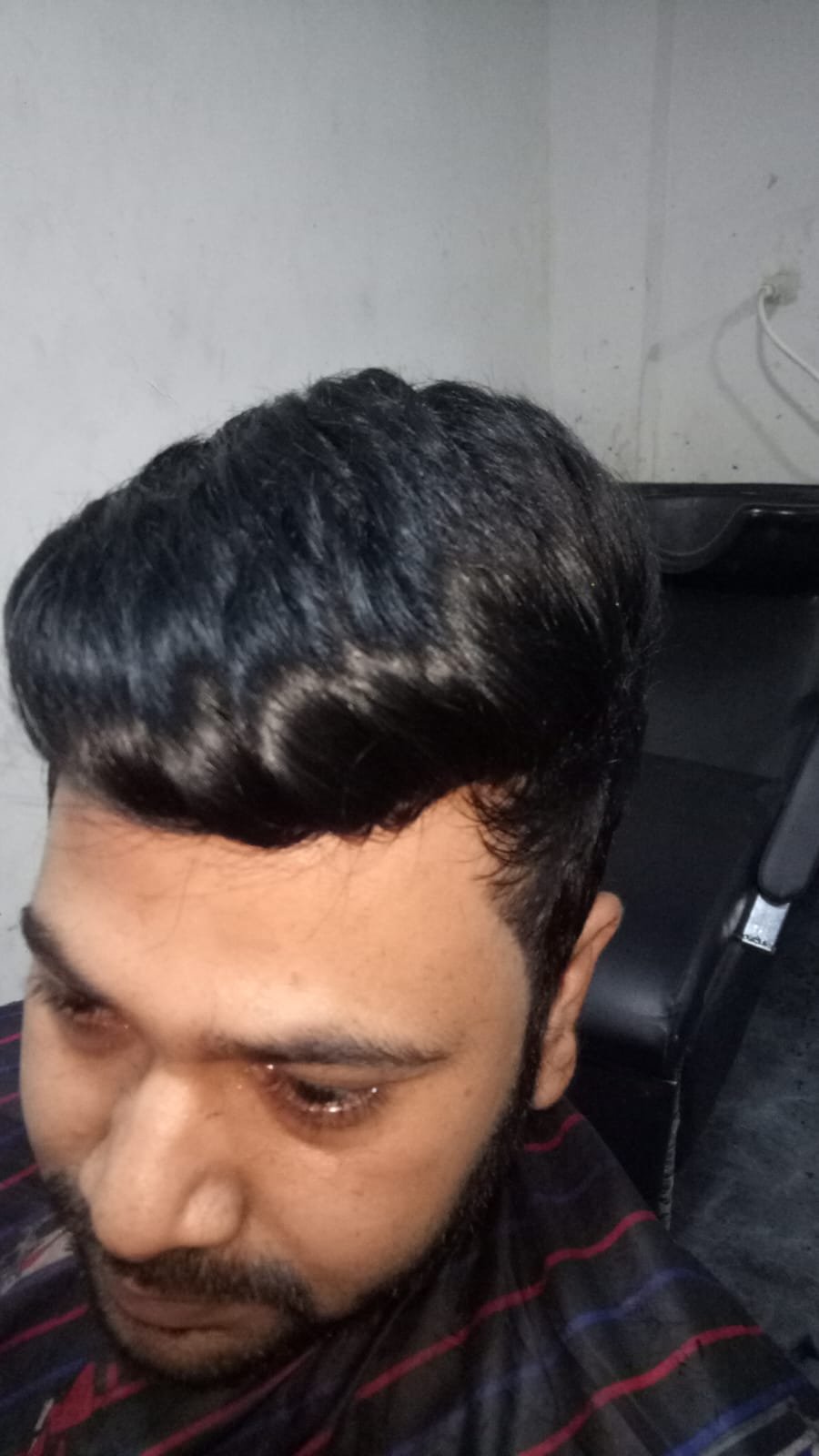After Hair Transformation
