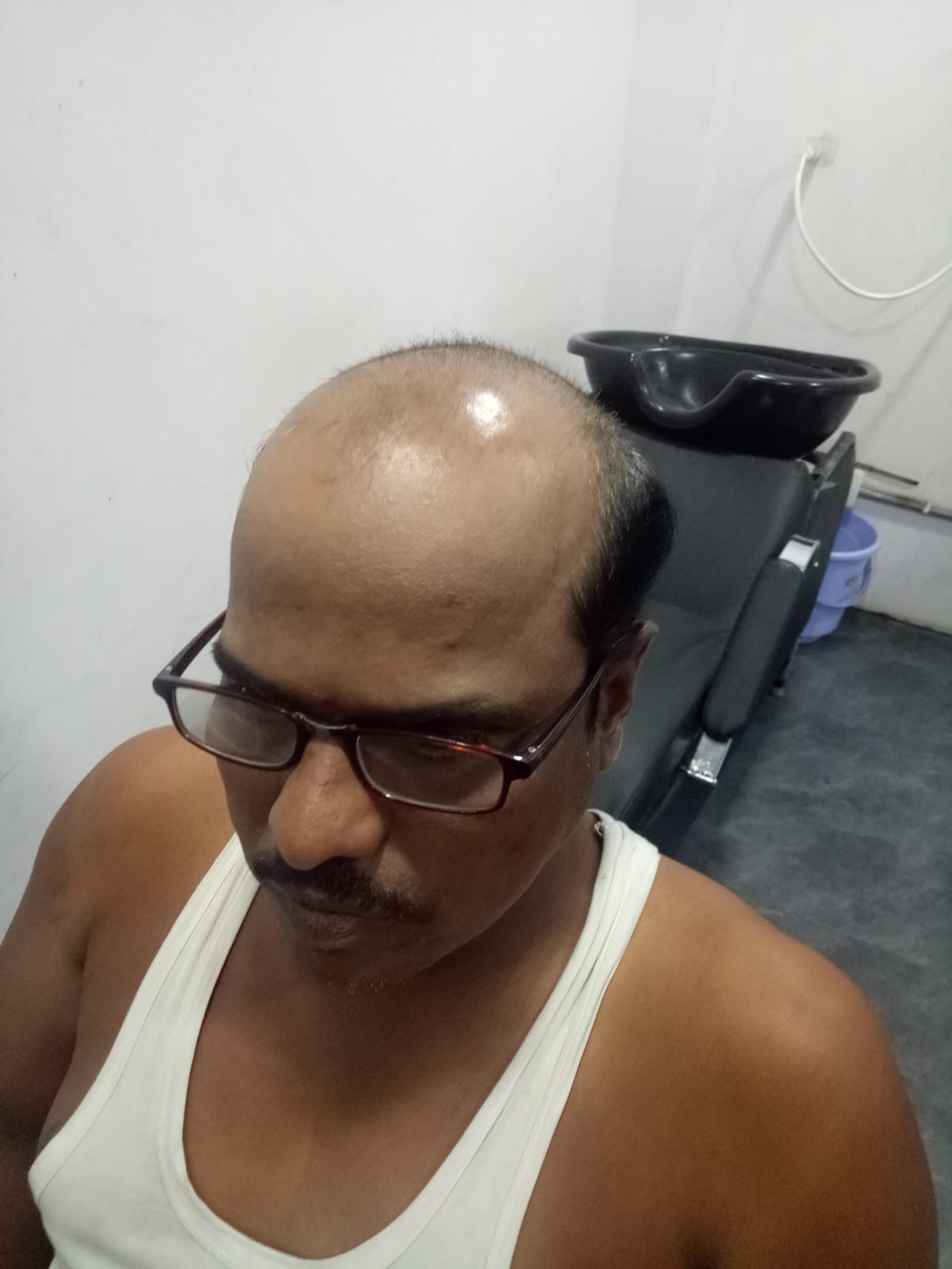 Before Hair Transformation